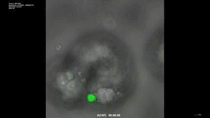 인플루엔자 바이러스(PR8-GFP)에 감염된 검은집박쥐 폐 오가노이드의 타임랩스 영상 세포자멸사(apoptosis)를 보이는 단일 세포에 초점을 맞췄다. /영상=IBS
