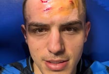 '뒷발 하이킥→피투성이' 그래도 웃었다!..."달콤한 상처" 아탈란타 영웅, UCL 16강 진출에 미소로 'SNS 인증'