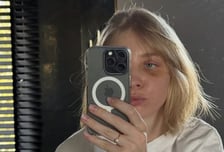 '스케이트 날에 안면 충돌' 피 철철 흘린 女 선수, 손흥민 받았던 그 수술 받았다...'얼굴 절반' 가린 근황 공개 "또 한 번 컴백홈"