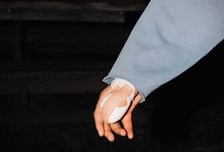 "손가락 절반 찢어졌다" 엄지에 붕대 칭칭...긴급 수술 후 근황 공개→"A매치 출전 가능성" 특별 훈련 소화한다