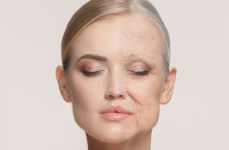 '저속노화' 시장이 뜬다