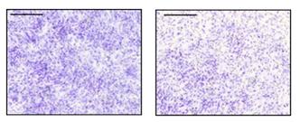 ▲류마티스 활막세포(파란 점)에 페리오스틴이나 트위스트의 유전자를 제거할 경우 세포침윤과 파괴성이 현저히 줄어든 모습(오른쪽 그림)(제공=보건복지부 보도자료)