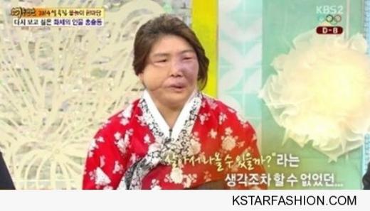 김희아 안면장애, 병마도 꺾지못한 희망전도사의 '모성애'