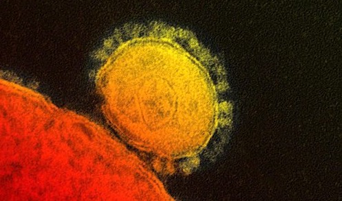 2012년 발생한 메르스 코로나 바이러스의 유전형질을 색상화해서 보여주고 있다. /사진=뉴시스