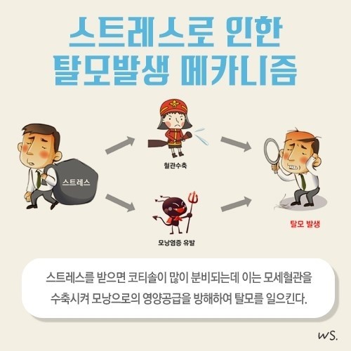 [홍성재 박사의 탈모 의학③] 탈모와 스트레스 8가지 이야기