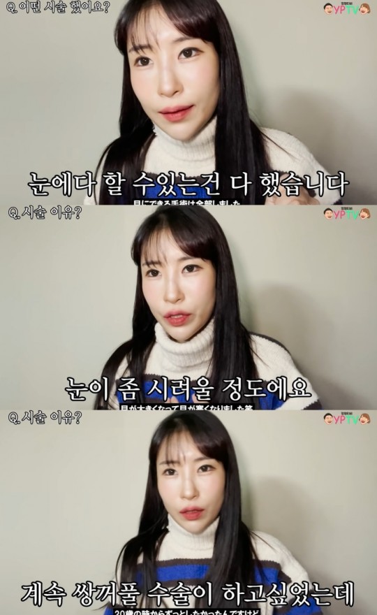 Comedian Lee Se-young Looking at the recent double eyelid surgery…  “Overcoming the Complex”