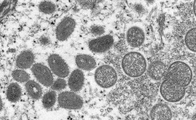국내 방역당국이 보유한 두창 백신을 당장 활용하기는 어렵다고 강조했다. 현미경으로 살펴본 원숭이두창 바이러스./사진=로이터
