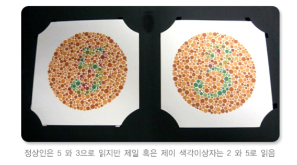 [헬스S] 넷플릭스 '더글로리' 속 복선 색약… 치료법은?