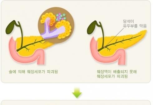 "그냥 숙취인 줄 알았는데"...당장 병원 가야 할 복통 신호